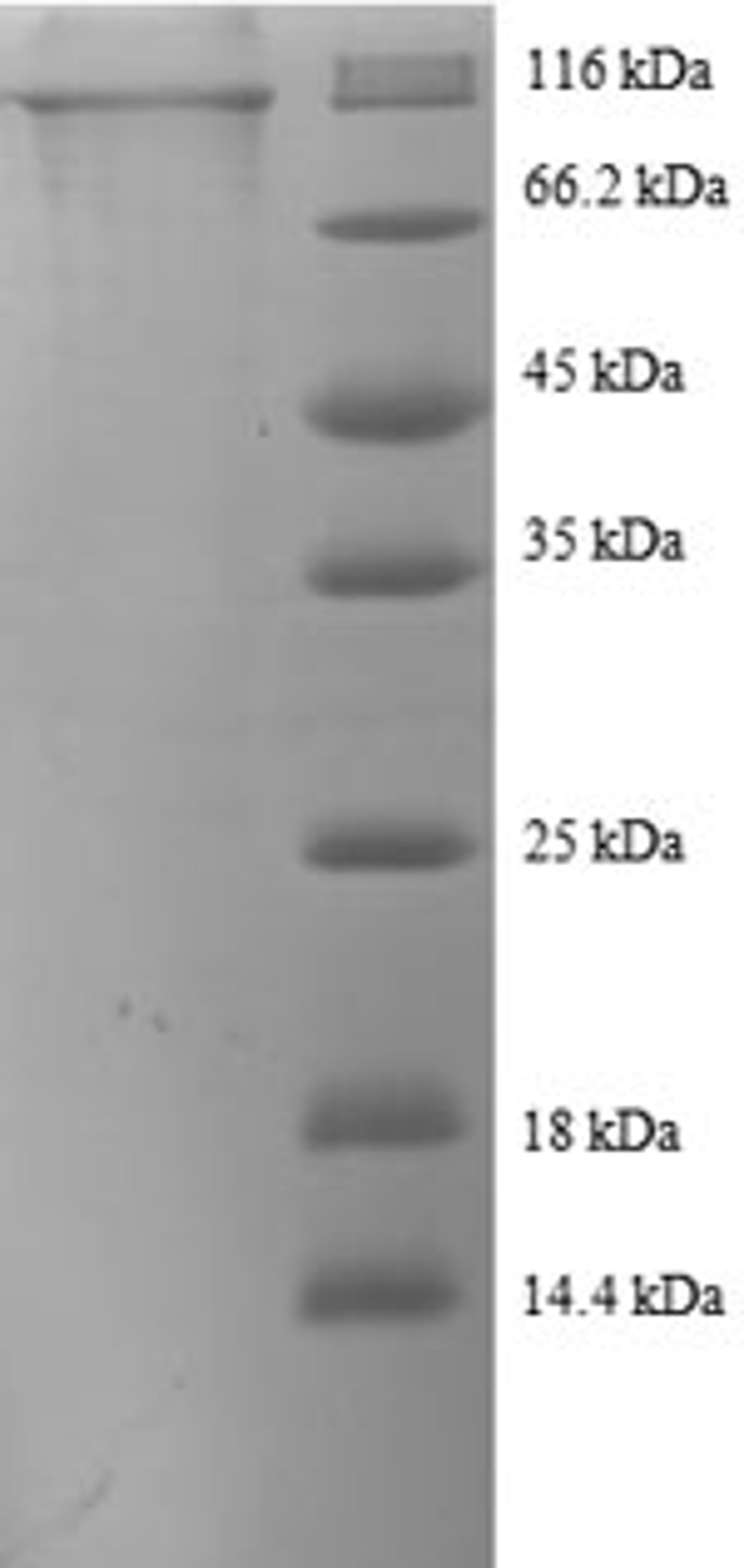 (Tris-Glycine gel) Discontinuous SDS-PAGE (reduced) with 5% enrichment gel and 15% separation gel.