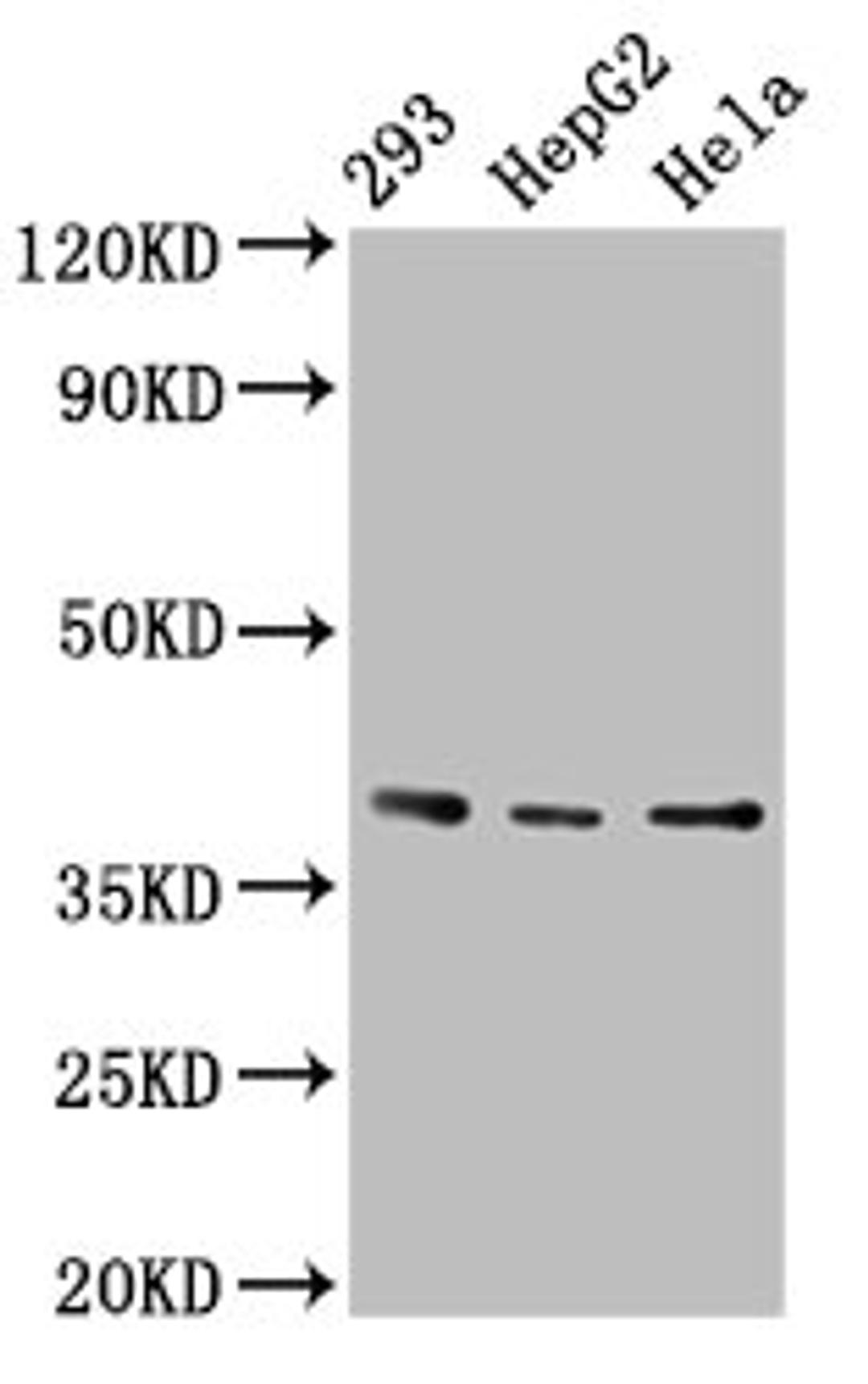 Western Blot. Positive WB detected in: 293 whole cell lysate, HepG2 whole cell lysate, Hela whole cell lysate. All lanes: PTGR2 antibody at 3.4µg/ml. Secondary. Goat polyclonal to rabbit IgG at 1/50000 dilution. Predicted band size: 39, 20 kDa. Observed band size: 39 kDa