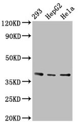 Western Blot. Positive WB detected in: 293 whole cell lysate, HepG2 whole cell lysate, Hela whole cell lysate. All lanes: PTGR2 antibody at 3.4µg/ml. Secondary. Goat polyclonal to rabbit IgG at 1/50000 dilution. Predicted band size: 39, 20 kDa. Observed band size: 39 kDa