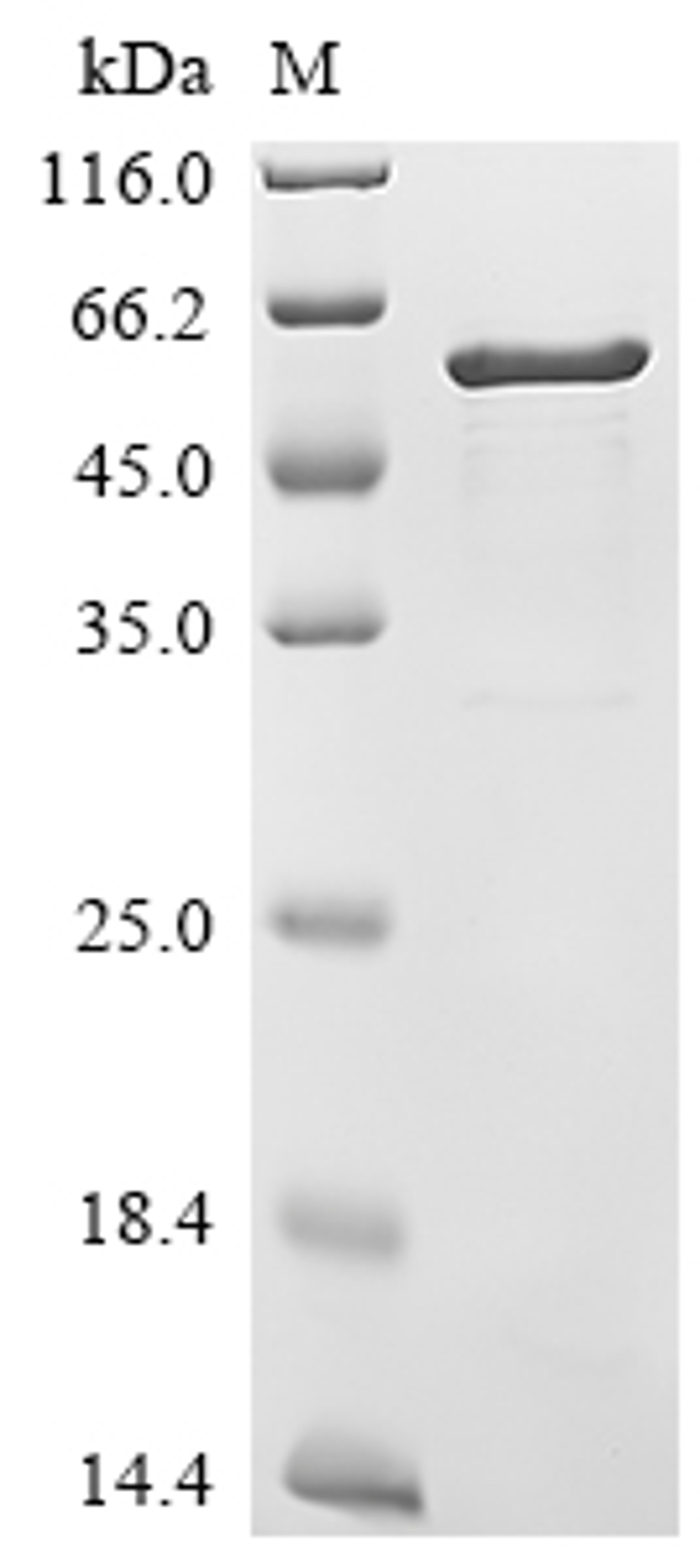(Tris-Glycine gel) Discontinuous SDS-PAGE (reduced) with 5% enrichment gel and 15% separation gel.