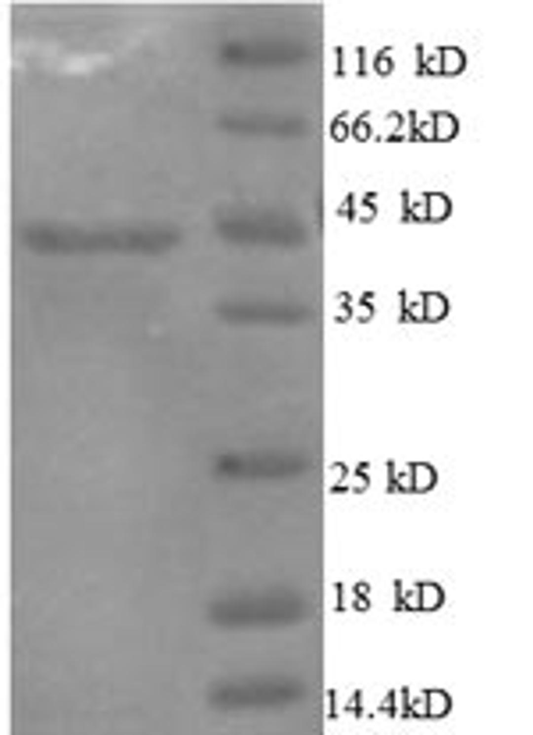 (Tris-Glycine gel) Discontinuous SDS-PAGE (reduced) with 5% enrichment gel and 15% separation gel.