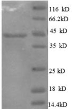 (Tris-Glycine gel) Discontinuous SDS-PAGE (reduced) with 5% enrichment gel and 15% separation gel.