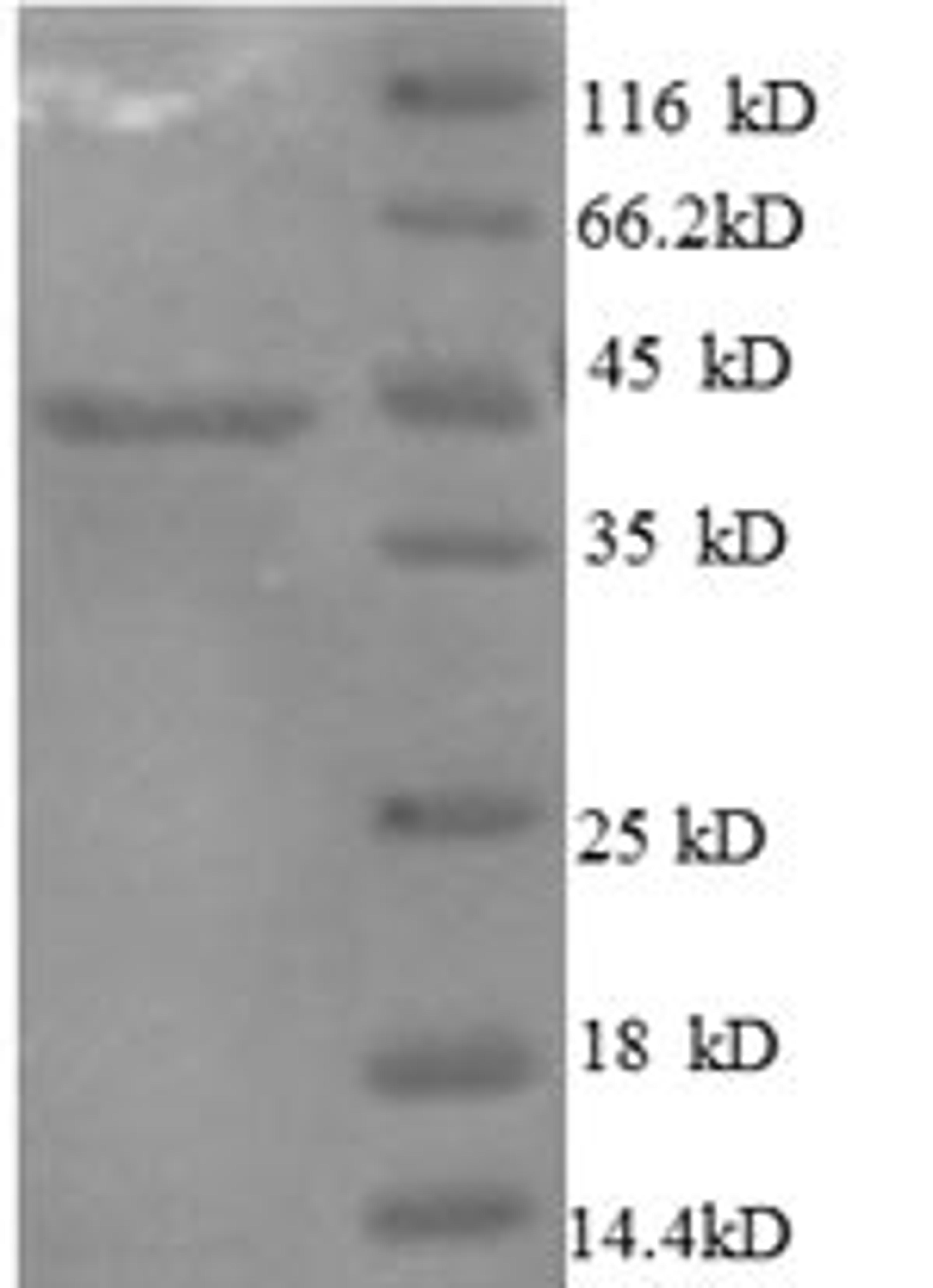 (Tris-Glycine gel) Discontinuous SDS-PAGE (reduced) with 5% enrichment gel and 15% separation gel.