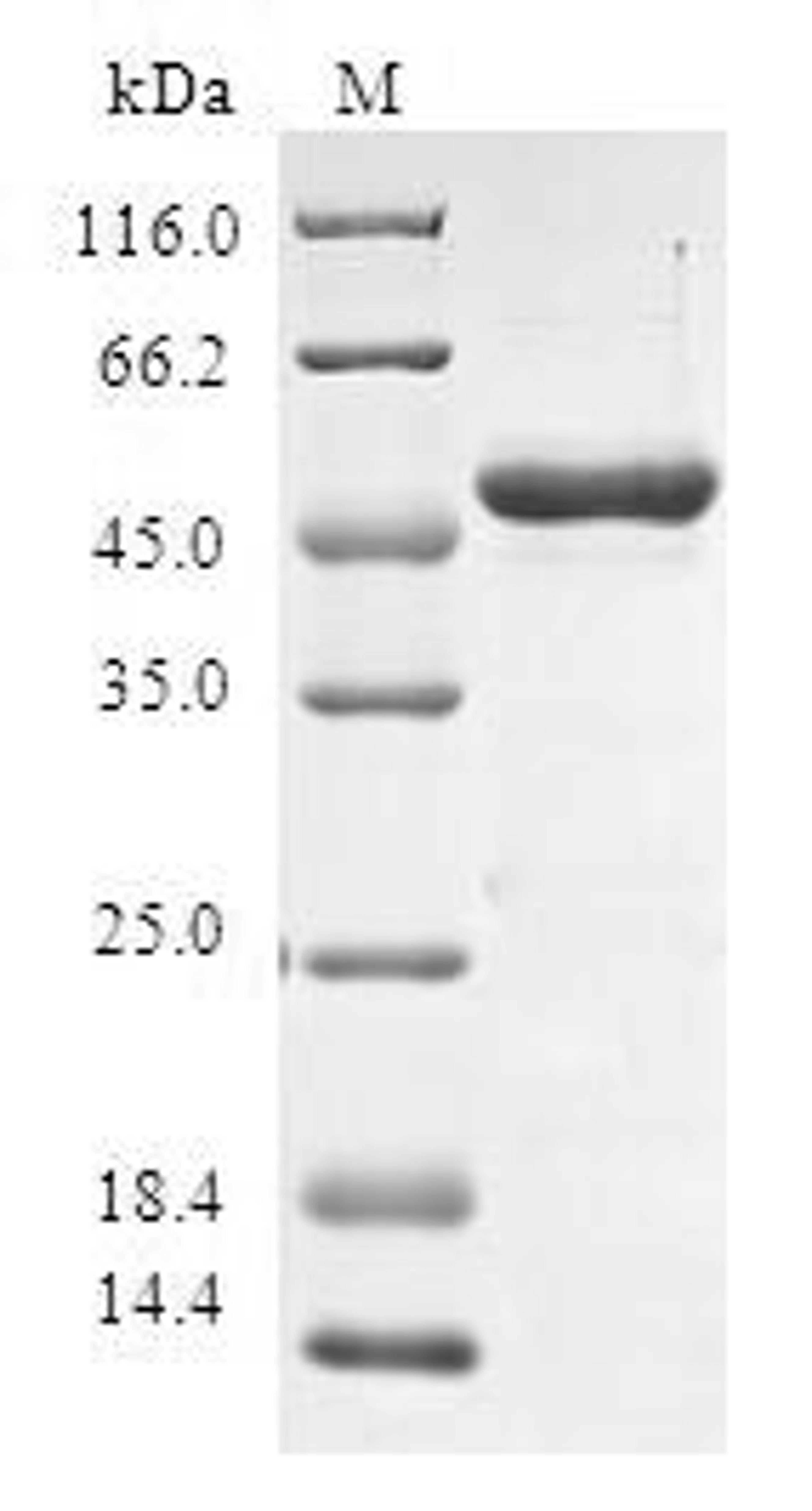 (Tris-Glycine gel) Discontinuous SDS-PAGE (reduced) with 5% enrichment gel and 15% separation gel.
