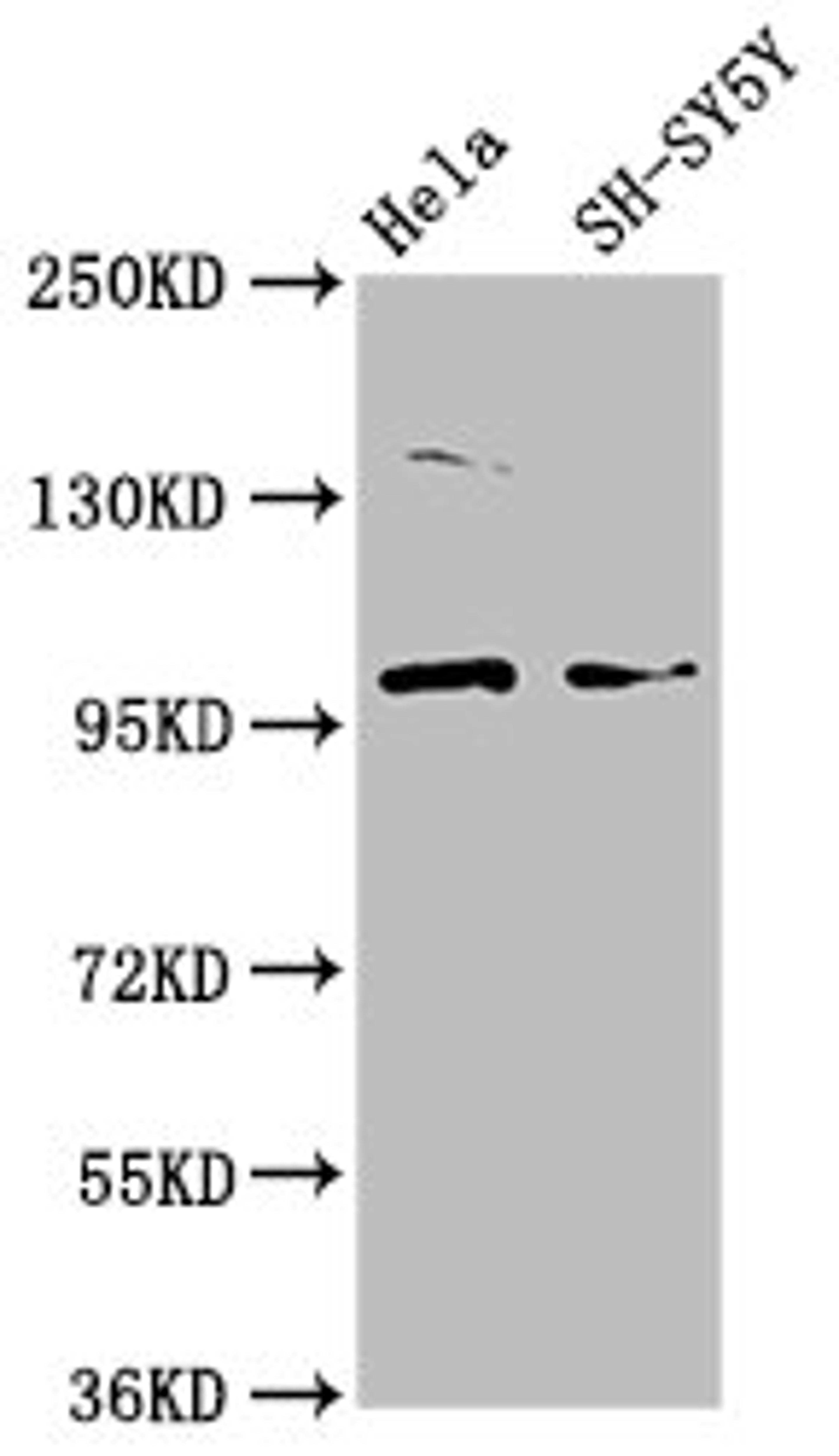 Western Blot. Positive WB detected in: Hela whole cell lysate, SH-SY5Y whole cell lysate. All lanes: PDE6C antibody at 3.7ug/ml. Secondary. Goat polyclonal to rabbit IgG at 1/50000 dilution. Predicted band size: 100 kDa. Observed band size: 100 kDa. 