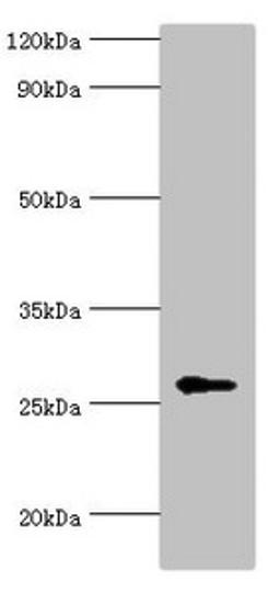 Western blot. All lanes: N-alpha-acetyltransferase 10 antibody at 5ug/ml + Hela whole cell lysate. Secondary. Goat polyclonal to rabbit IgG at 1/10000 dilution. Predicted band size: 27, 25 kDa. Observed band size: 27 kDa. 