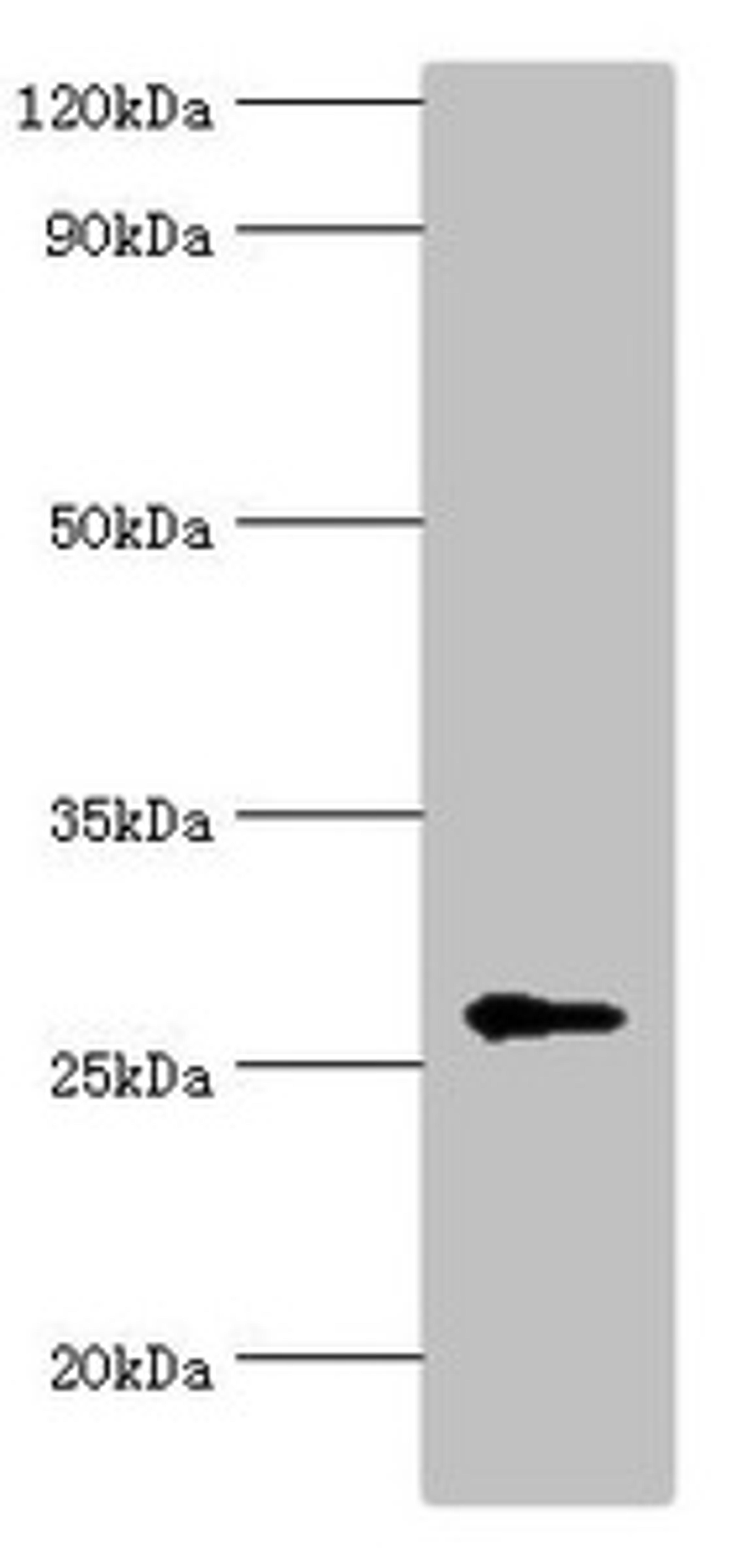 Western blot. All lanes: N-alpha-acetyltransferase 10 antibody at 5ug/ml + Hela whole cell lysate. Secondary. Goat polyclonal to rabbit IgG at 1/10000 dilution. Predicted band size: 27, 25 kDa. Observed band size: 27 kDa. 
