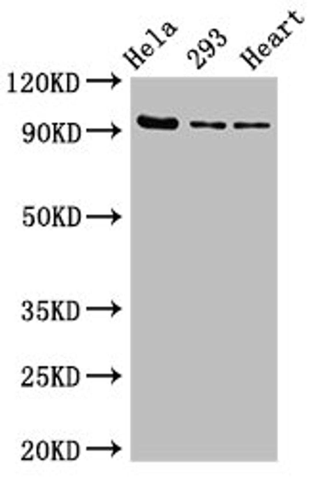 Western Blot. Positive WB detected in: Hela whole cell lysate, 293 whole cell lysate, Rat heart tissue. All lanes: MCM4 antibody at 2.7µg/ml. Secondary. Goat polyclonal to rabbit IgG at 1/50000 dilution. Predicted band size: 97 kDa. Observed band size: 97 kDa
