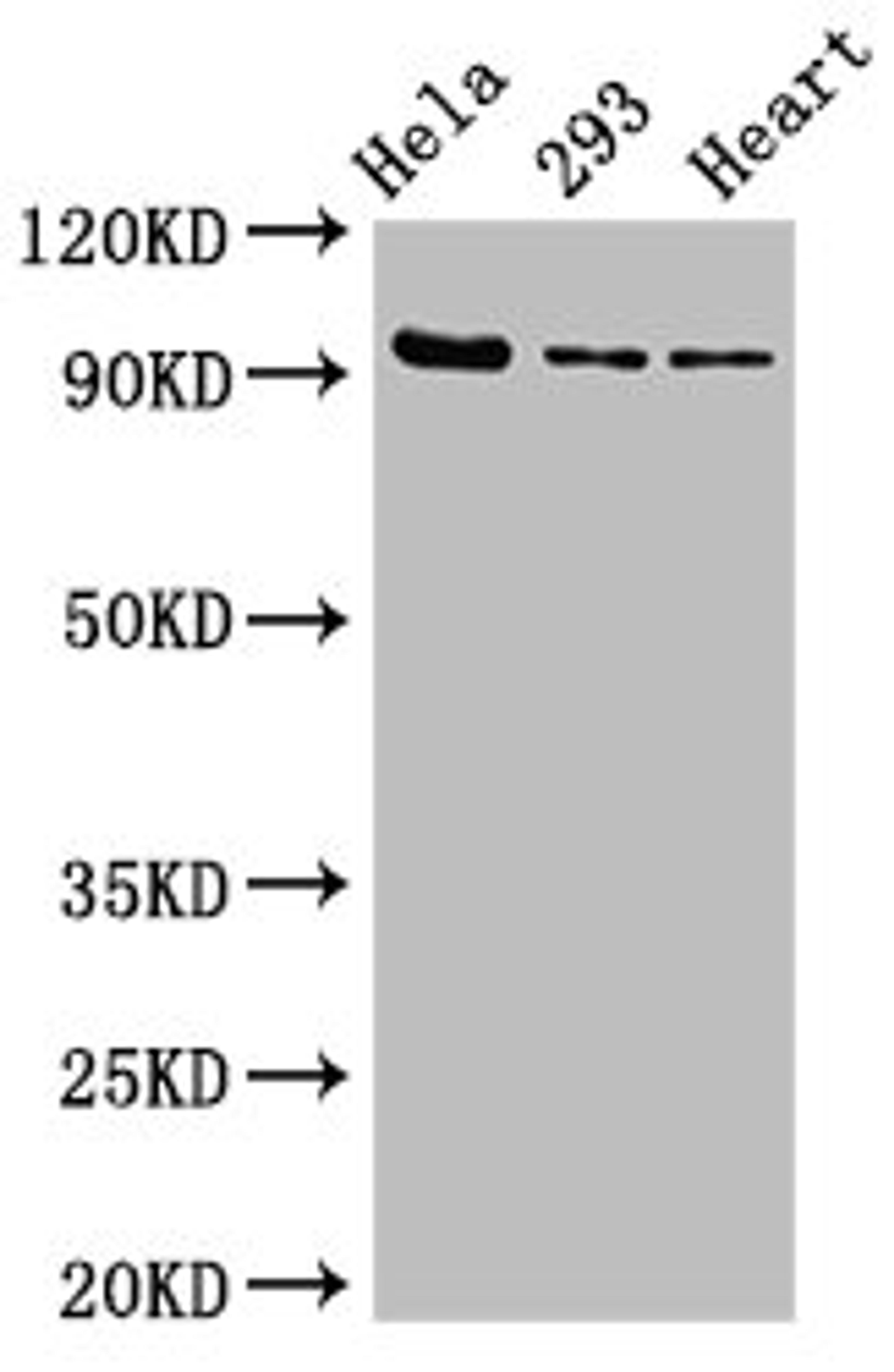Western Blot. Positive WB detected in: Hela whole cell lysate, 293 whole cell lysate, Rat heart tissue. All lanes: MCM4 antibody at 2.7µg/ml. Secondary. Goat polyclonal to rabbit IgG at 1/50000 dilution. Predicted band size: 97 kDa. Observed band size: 97 kDa