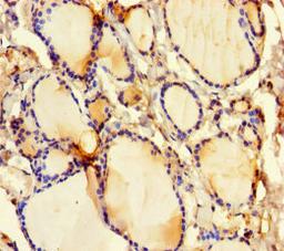 Immunohistochemistry of paraffin-embedded human thyroid tissue using CSB-PA006766LA01HU at dilution of 1:100