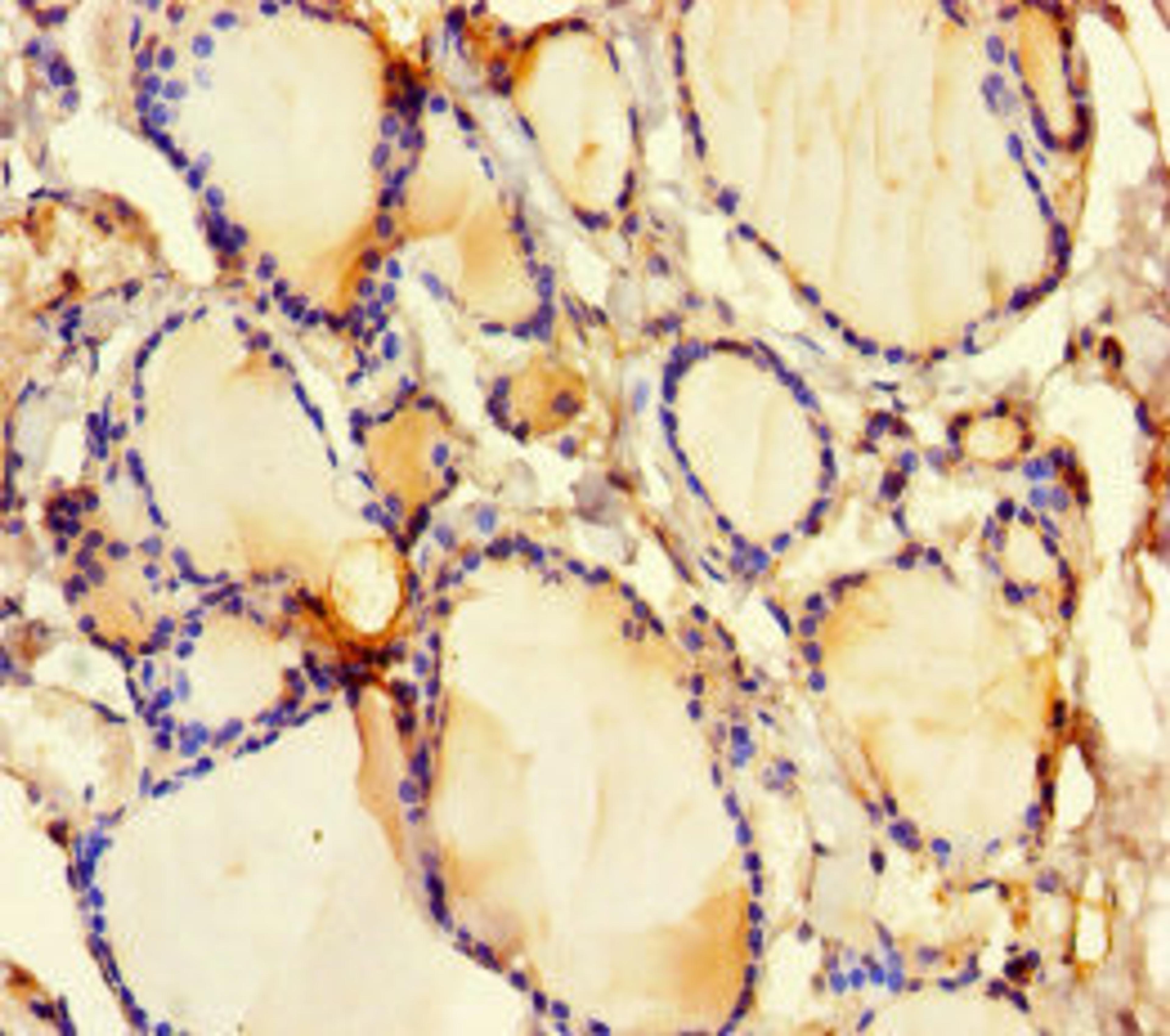 Immunohistochemistry of paraffin-embedded human thyroid tissue using CSB-PA006766LA01HU at dilution of 1:100