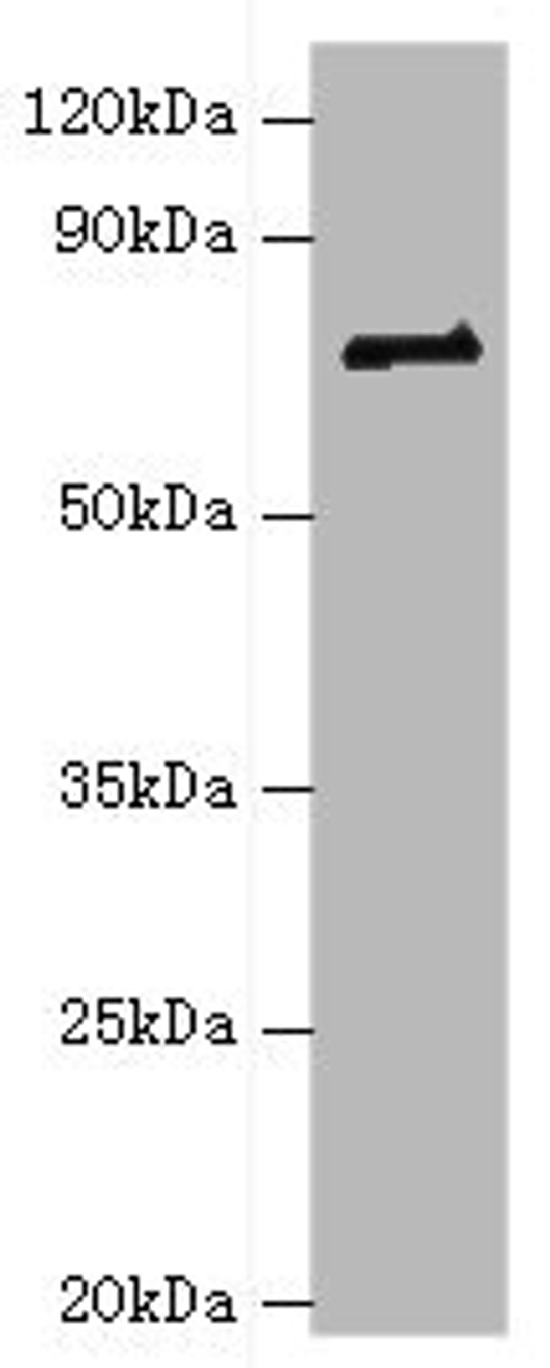 Western blot. All lanes: HNRNPM antibody at 2ug/ml + NIH/3T3 whole cell lysate. Secondary. Goat polyclonal to rabbit IgG at 1/10000 dilution. Predicted band size: 78, 74 kDa. Observed band size: 78 kDa. 