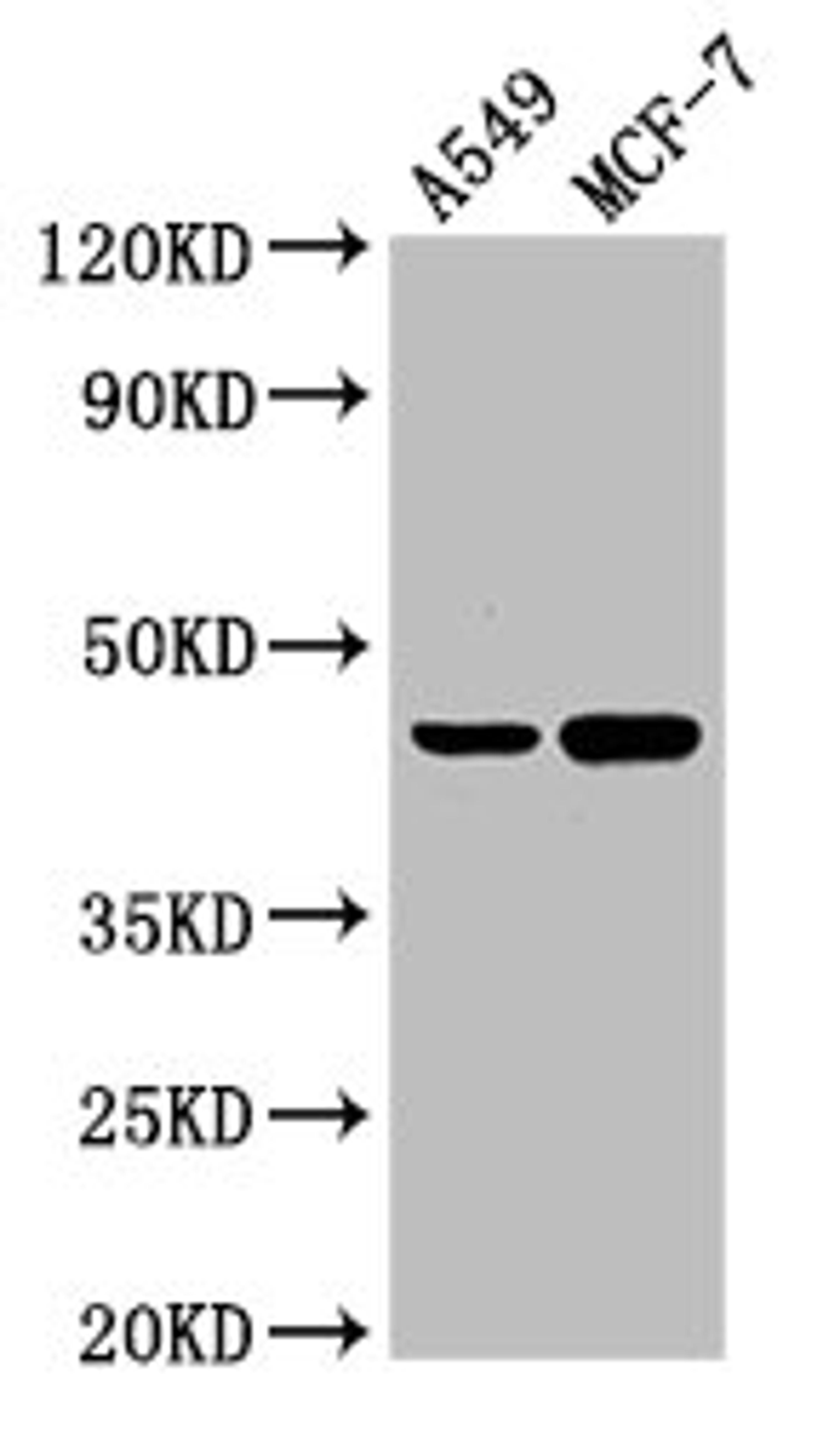 Western Blot. Positive WB detected in: A549 whole cell lysate, MCF-7 whole cell lysate. All lanes: AGXT antibody at 3µg/ml. Secondary. Goat polyclonal to rabbit IgG at 1/50000 dilution. Predicted band size: 44 kDa. Observed band size: 44 kDa