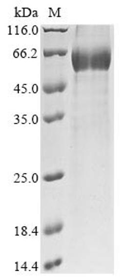 (Tris-Glycine gel) Discontinuous SDS-PAGE (reduced) with 5% enrichment gel and 15% separation gel.