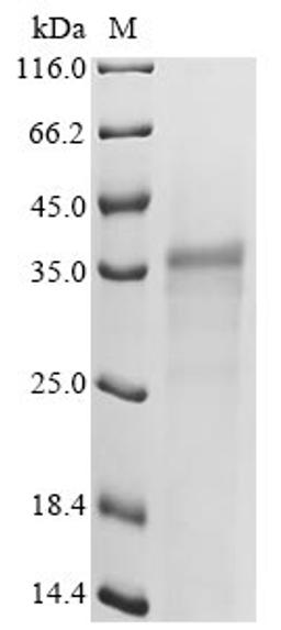 (Tris-Glycine gel) Discontinuous SDS-PAGE (reduced) with 5% enrichment gel and 15% separation gel.