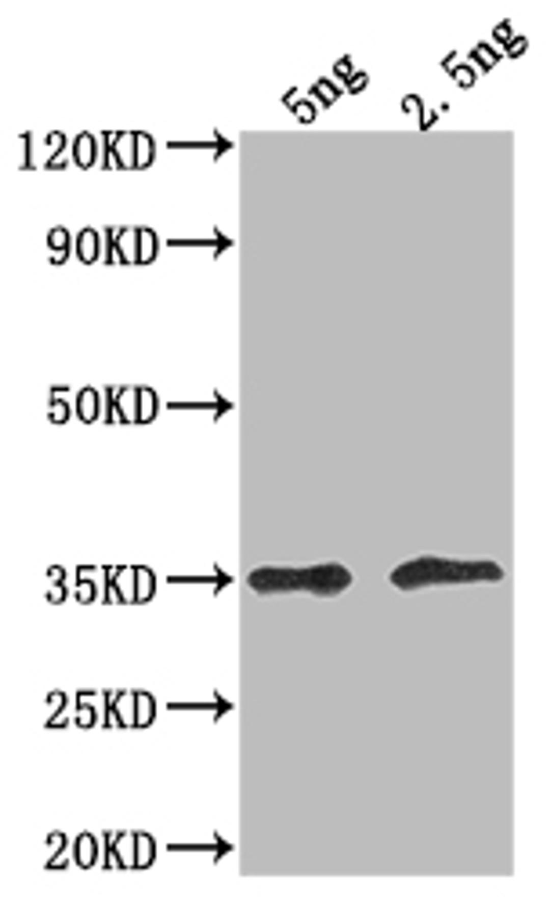 Western Blot. Positive WB detected in Recombinant protein. All lanes: DOT5 antibody at 1:2000. Secondary. Goat polyclonal to rabbit IgG at 1/50000 dilution. Predicted band size: 28.2 kDa. Observed band size: 36 kDa. 