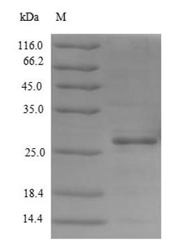 (Tris-Glycine gel) Discontinuous SDS-PAGE (reduced) with 5% enrichment gel and 15% separation gel.