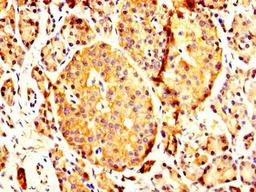 IHC image of CSB-PA017618LA01HU diluted at 1:200 and staining in paraffin-embedded human pancreatic tissue performed on a Leica BondTM system. After dewaxing and hydration, antigen retrieval was mediated by high pressure in a citrate buffer (pH 6.0). Section was blocked with 10% normal goat serum 30min at RT. Then primary antibody (1% BSA) was incubated at 4&deg;C overnight. The primary is detected by a biotinylated secondary antibody and visualized using an HRP conjugated SP system.