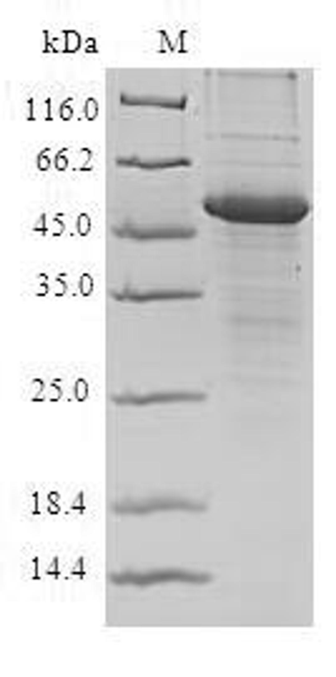 (Tris-Glycine gel) Discontinuous SDS-PAGE (reduced) with 5% enrichment gel and 15% separation gel.