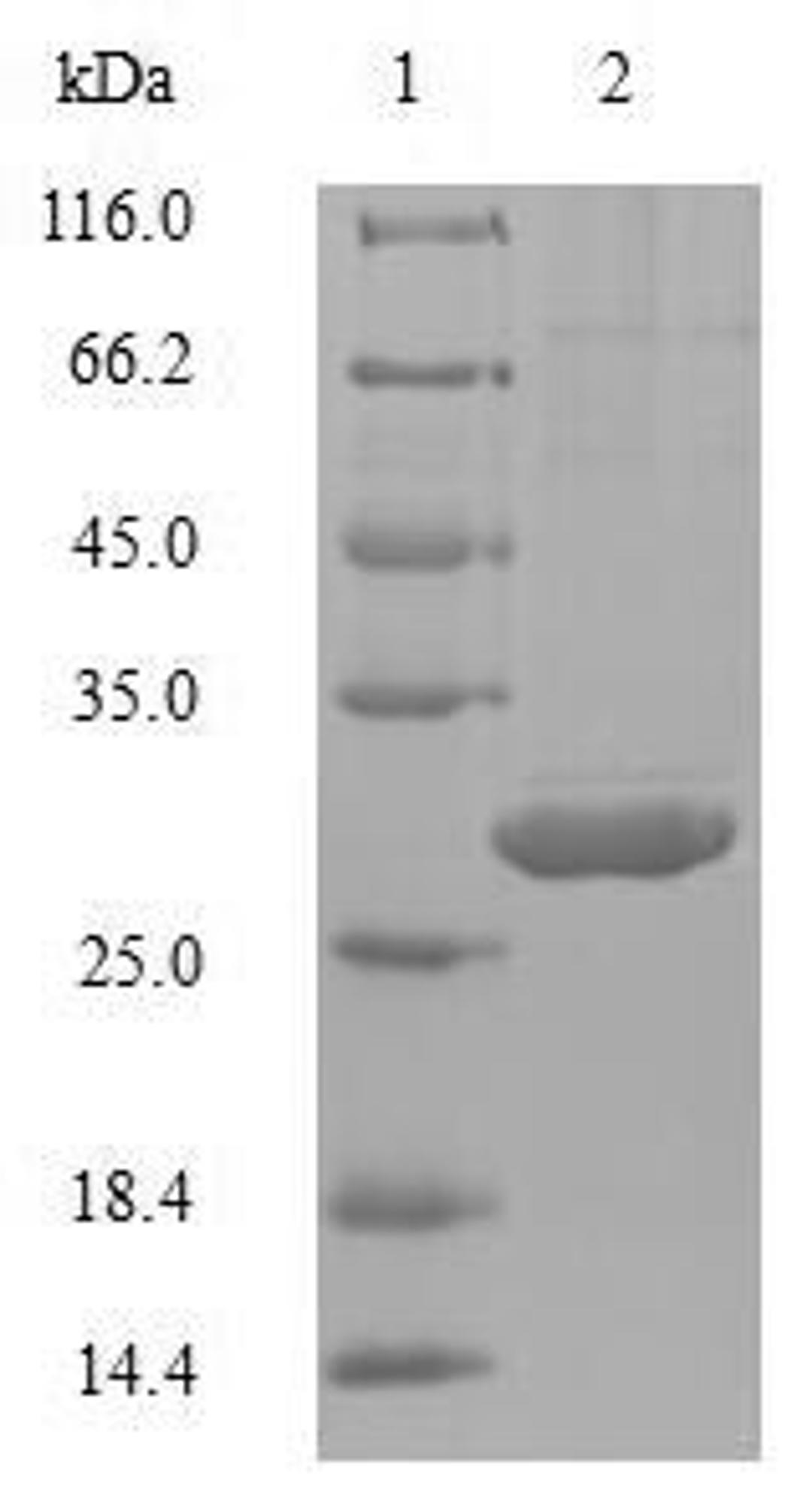 (Tris-Glycine gel) Discontinuous SDS-PAGE (reduced) with 5% enrichment gel and 15% separation gel.