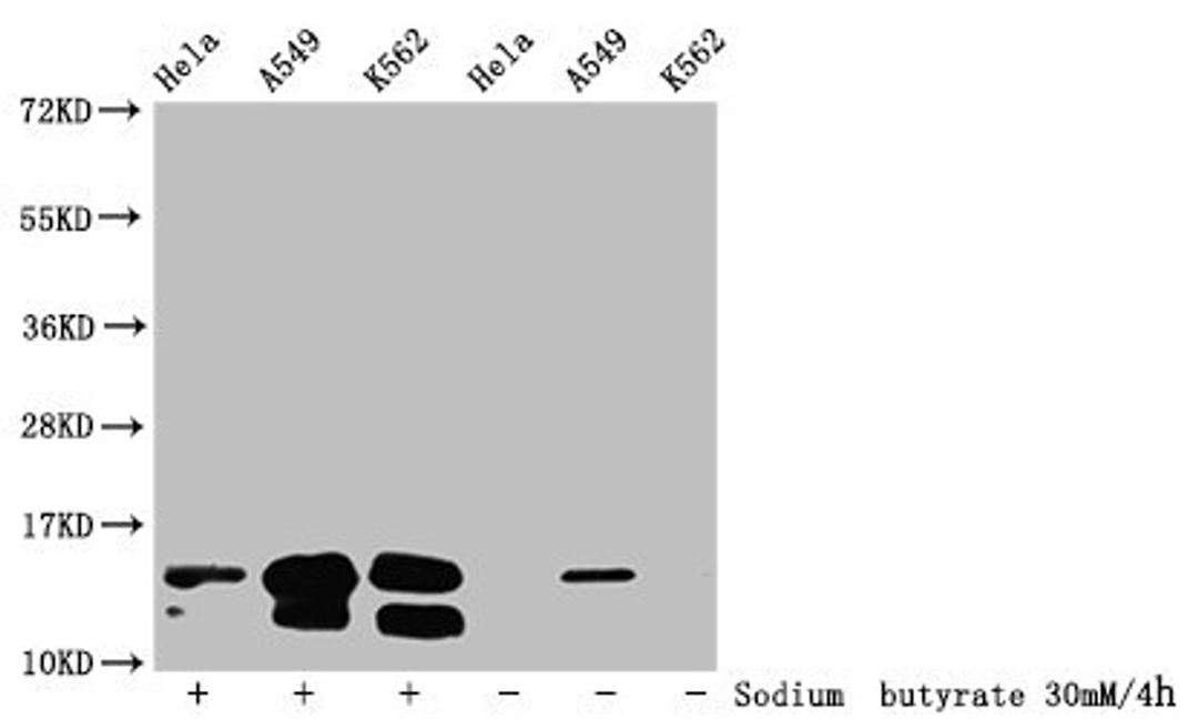 Western Blot. Detected samples: Hela whole cell lysate, A549 whole cell lysate, K562 whole cell lysate; Untreated (-) or treated (+) with 30mM sodium butyrate for 4h. All lanes: HIST1H2BC antibody at 1:100. Secondary. Goat polyclonal to rabbit IgG at 1/50000 dilution. Predicted band size: 14 kDa. Observed band size: 14 kDa