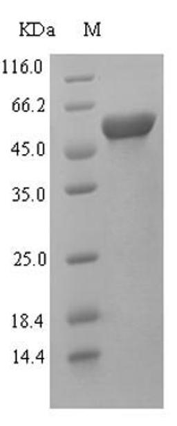 (Tris-Glycine gel) Discontinuous SDS-PAGE (reduced) with 5% enrichment gel and 15% separation gel.