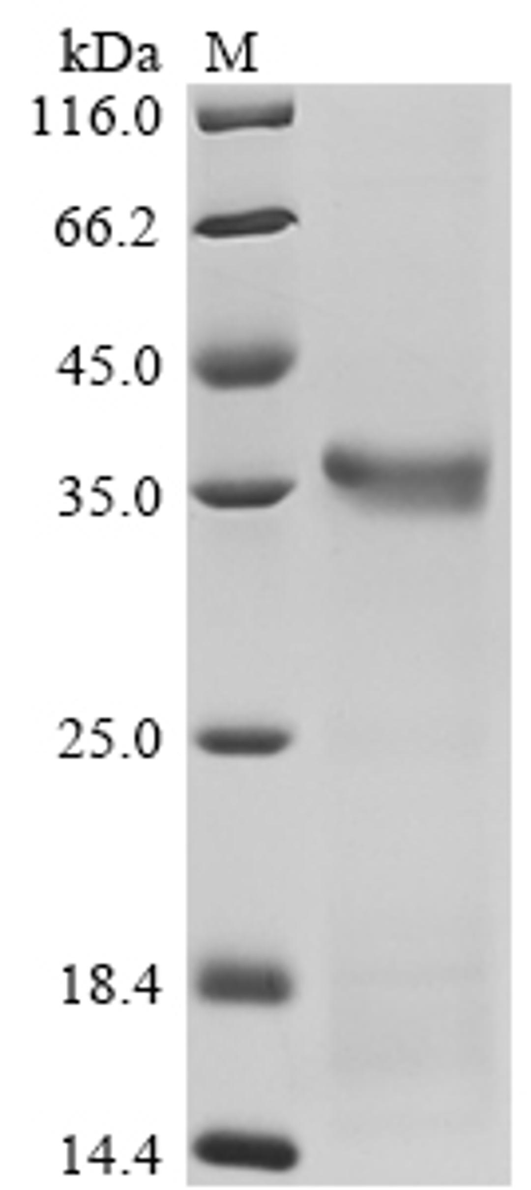(Tris-Glycine gel) Discontinuous SDS-PAGE (reduced) with 5% enrichment gel and 15% separation gel.