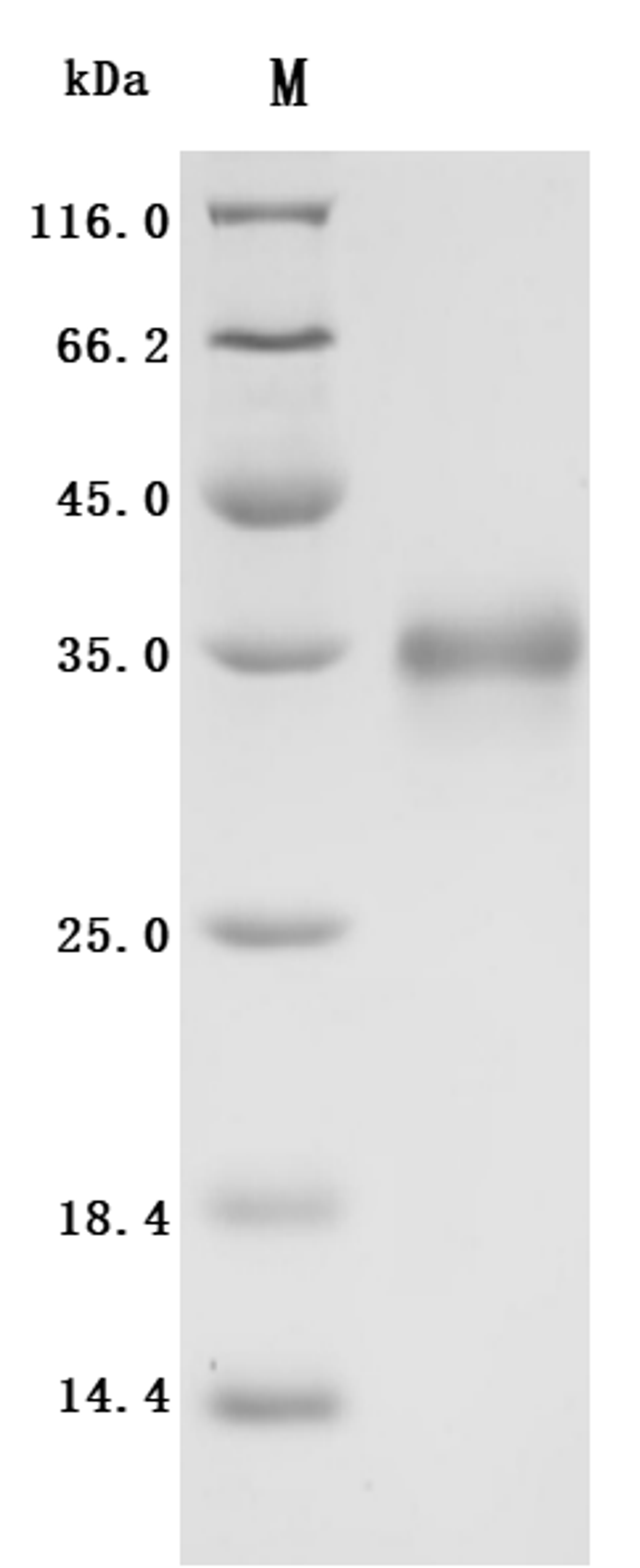(Tris-Glycine gel) Discontinuous SDS-PAGE (reduced) with 5% enrichment gel and 15% separation gel.
