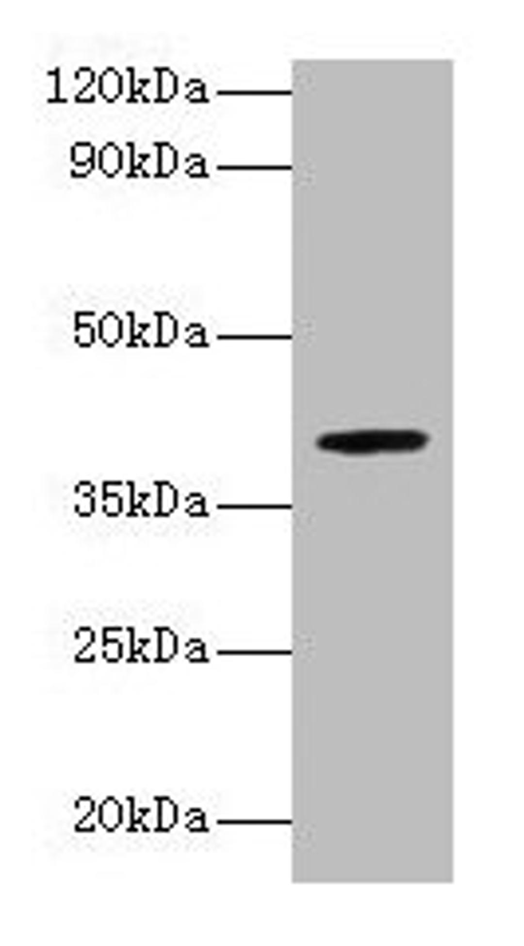 Western blot. All lanes: ARSB antibody at 2µg/ml + Mouse brain tissue. Secondary. Goat polyclonal to rabbit lgG at 1/15000 dilution. Predicted band size: 60, 46 kDa. Observed band size: 40 kDa