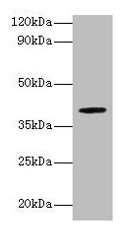 Western blot. All lanes: ARSB antibody at 2µg/ml + Mouse brain tissue. Secondary. Goat polyclonal to rabbit lgG at 1/15000 dilution. Predicted band size: 60, 46 kDa. Observed band size: 40 kDa