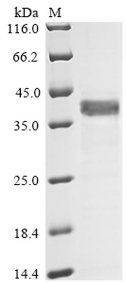 (Tris-Glycine gel) Discontinuous SDS-PAGE (reduced) with 5% enrichment gel and 15% separation gel.