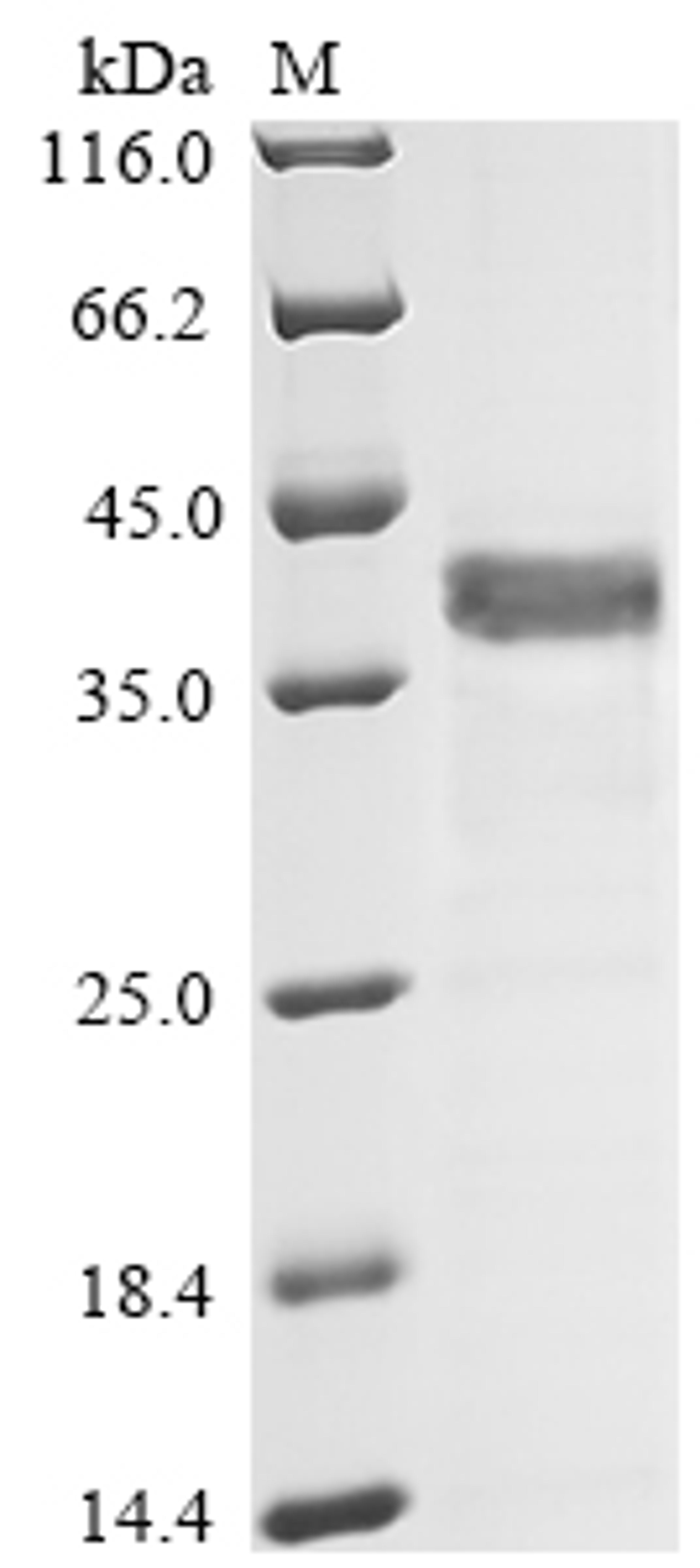 (Tris-Glycine gel) Discontinuous SDS-PAGE (reduced) with 5% enrichment gel and 15% separation gel.