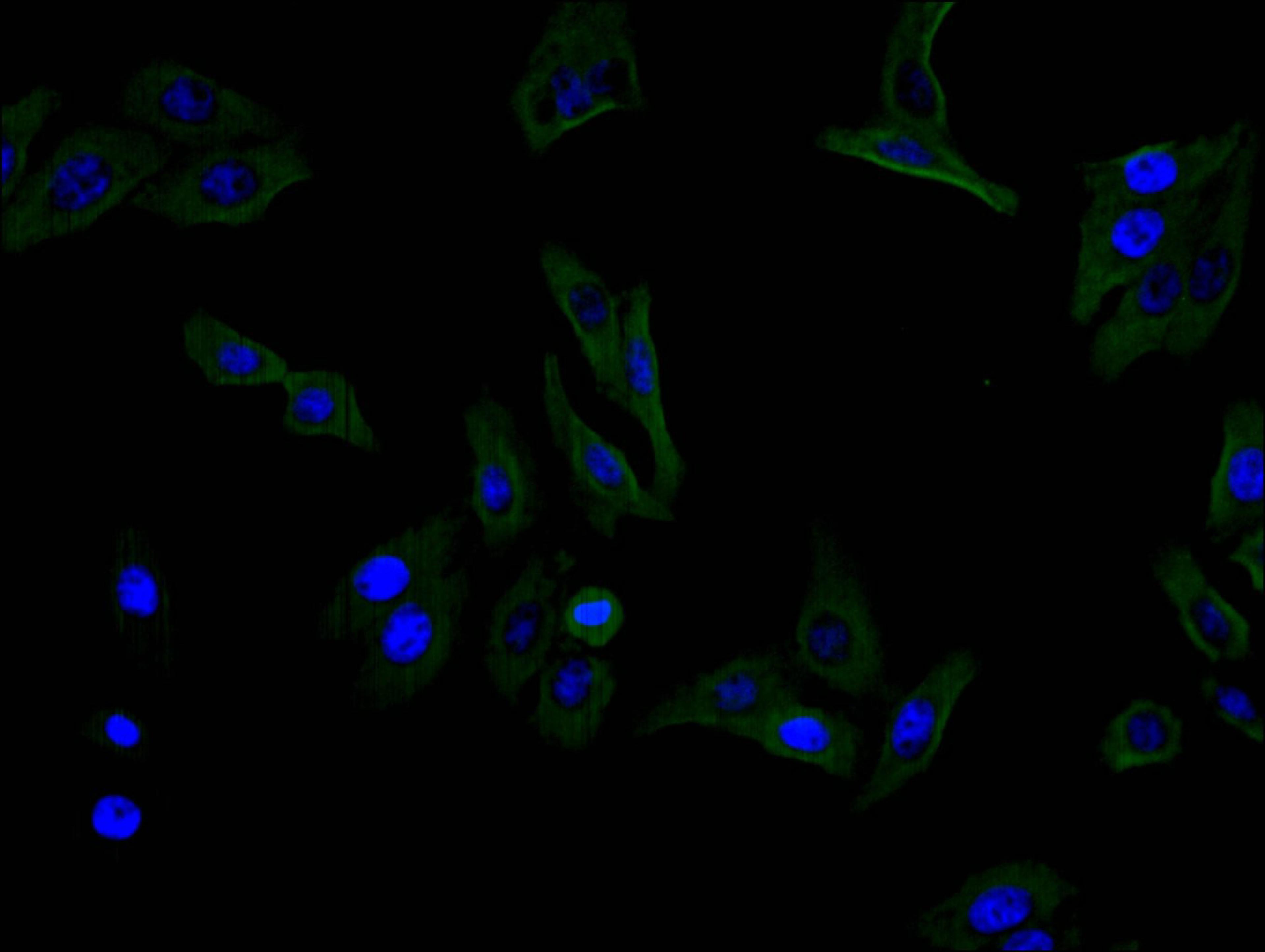 Immunofluorescence staining of HEPG2 cell with CSB-RA001827MA1HU at 1:100, counter-stained with DAPI. The cells were fixed in 4% formaldehyde and blocked in 10% normal Goat Serum. The cells were then incubated with the antibody overnight at 4C. The secondary antibody was FITC-conjugated AffiniPure Goat Anti-Mouse IgG(H+L).
