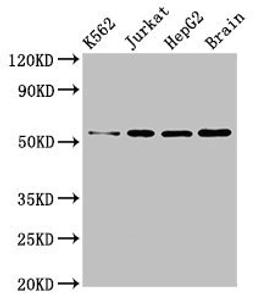 Western Blot. Positive WB detected in: K562 whole cell lysate, Jurkat whole cell lysate, HepG2 whole cell lysate, Mouse brain tissue. All lanes: SLC16A8 antibody at 3µg/ml. Secondary. Goat polyclonal to rabbit IgG at 1/50000 dilution. Predicted band size: 53 kDa. Observed band size: 53 kDa