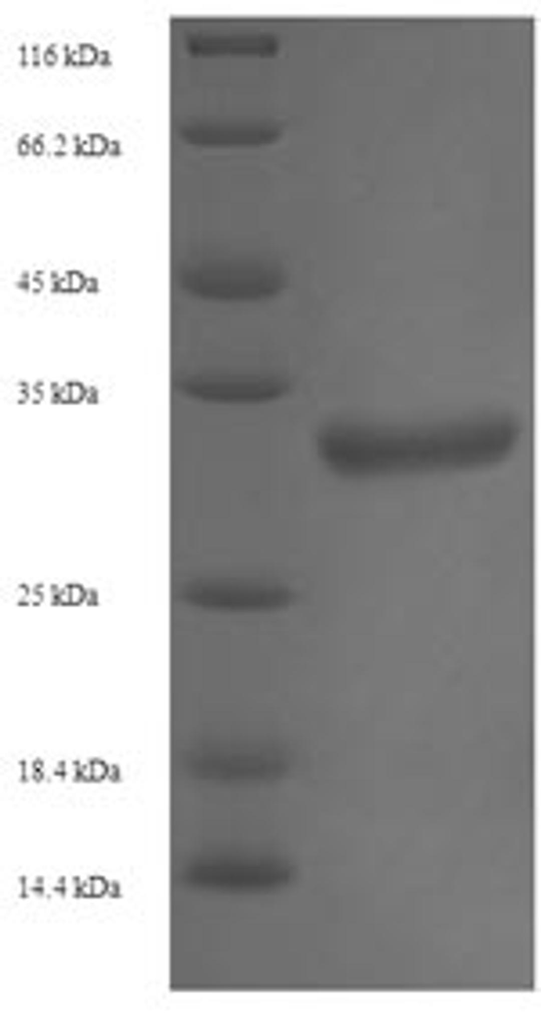 (Tris-Glycine gel) Discontinuous SDS-PAGE (reduced) with 5% enrichment gel and 15% separation gel.