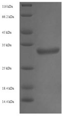 (Tris-Glycine gel) Discontinuous SDS-PAGE (reduced) with 5% enrichment gel and 15% separation gel.