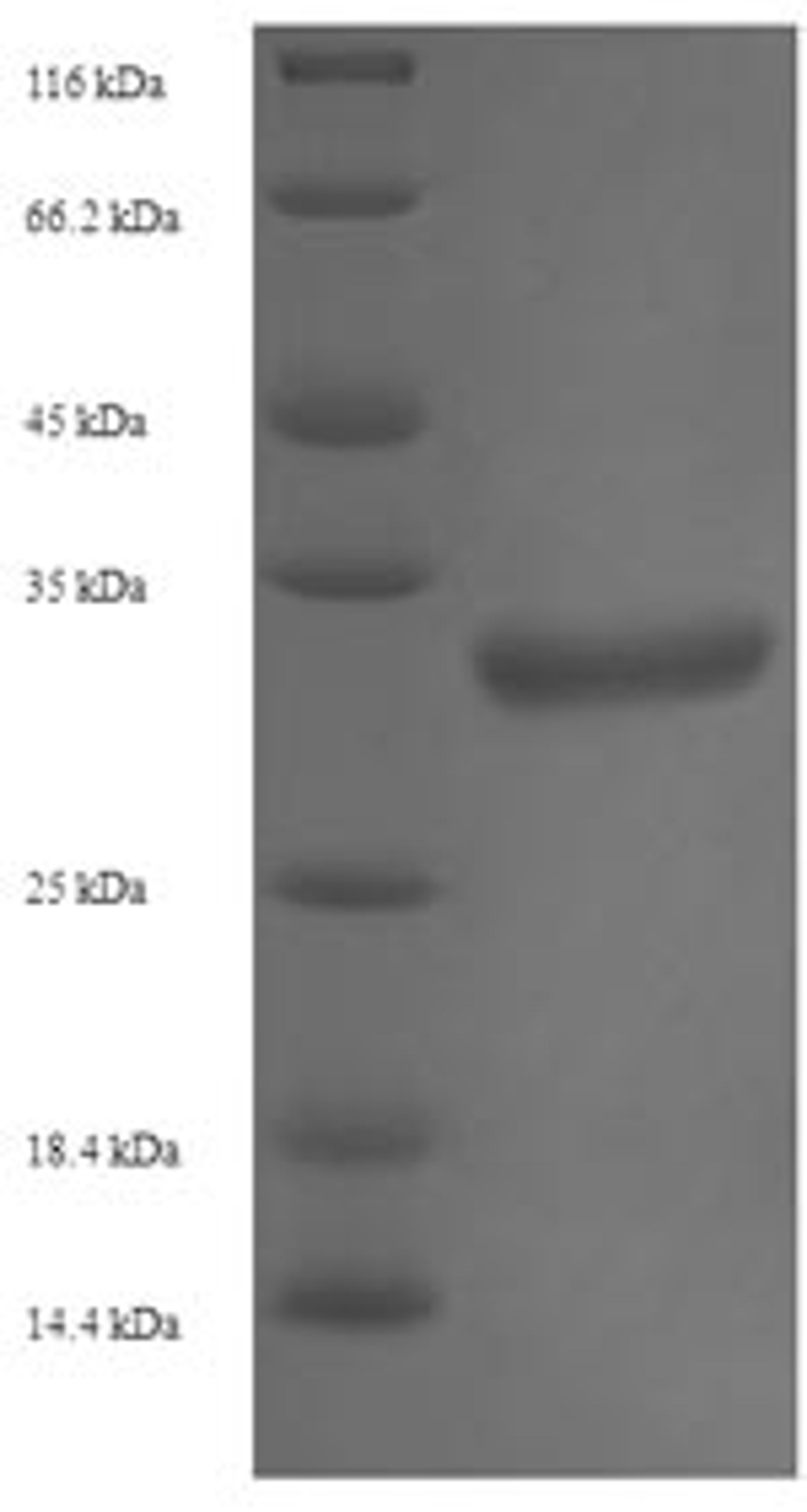 (Tris-Glycine gel) Discontinuous SDS-PAGE (reduced) with 5% enrichment gel and 15% separation gel.