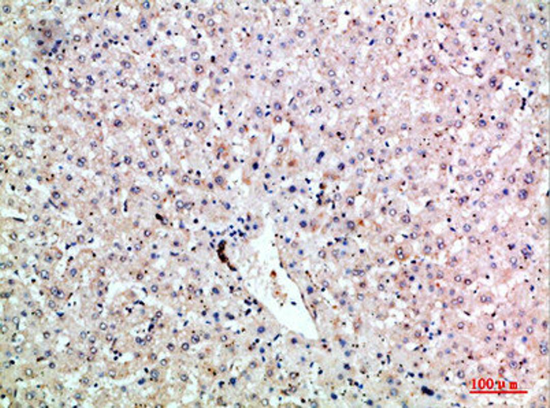 Immunohistochemical analysis of paraffin-embedded human-liver, antibody was diluted at 1:200