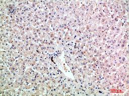 Immunohistochemical analysis of paraffin-embedded human-liver, antibody was diluted at 1:200