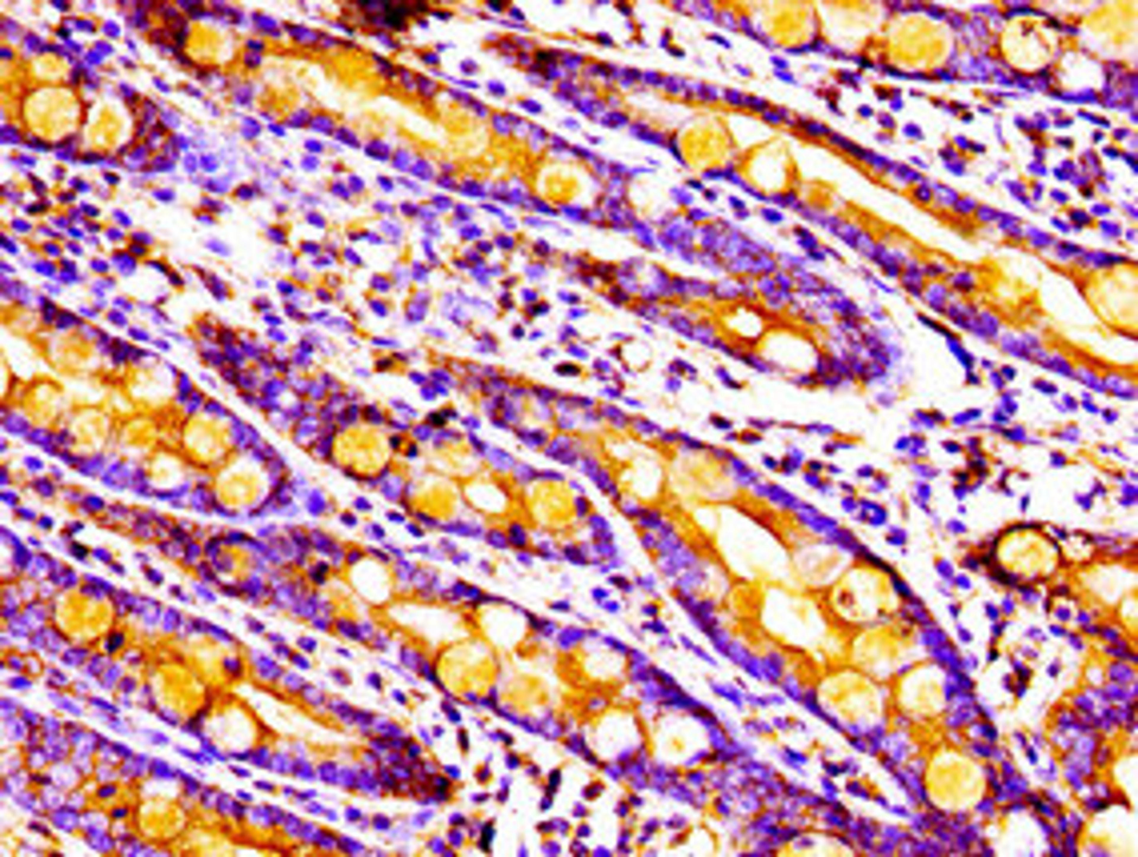 Immunohistochemistry of paraffin-embedded human small intestine tissue using CSB-PA014770LA01HU at dilution of 1:100