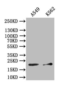Western Blot. Positive WB detected in: A549 whole cell lysate, K562 whole cell lysate. All lanes: NPPB antibody at 1:1000. Secondary. Goat polyclonal to rabbit IgG at 1/50000 dilution. Predicted band size: 15-25 kDa. Observed band size: 20 kDa. 