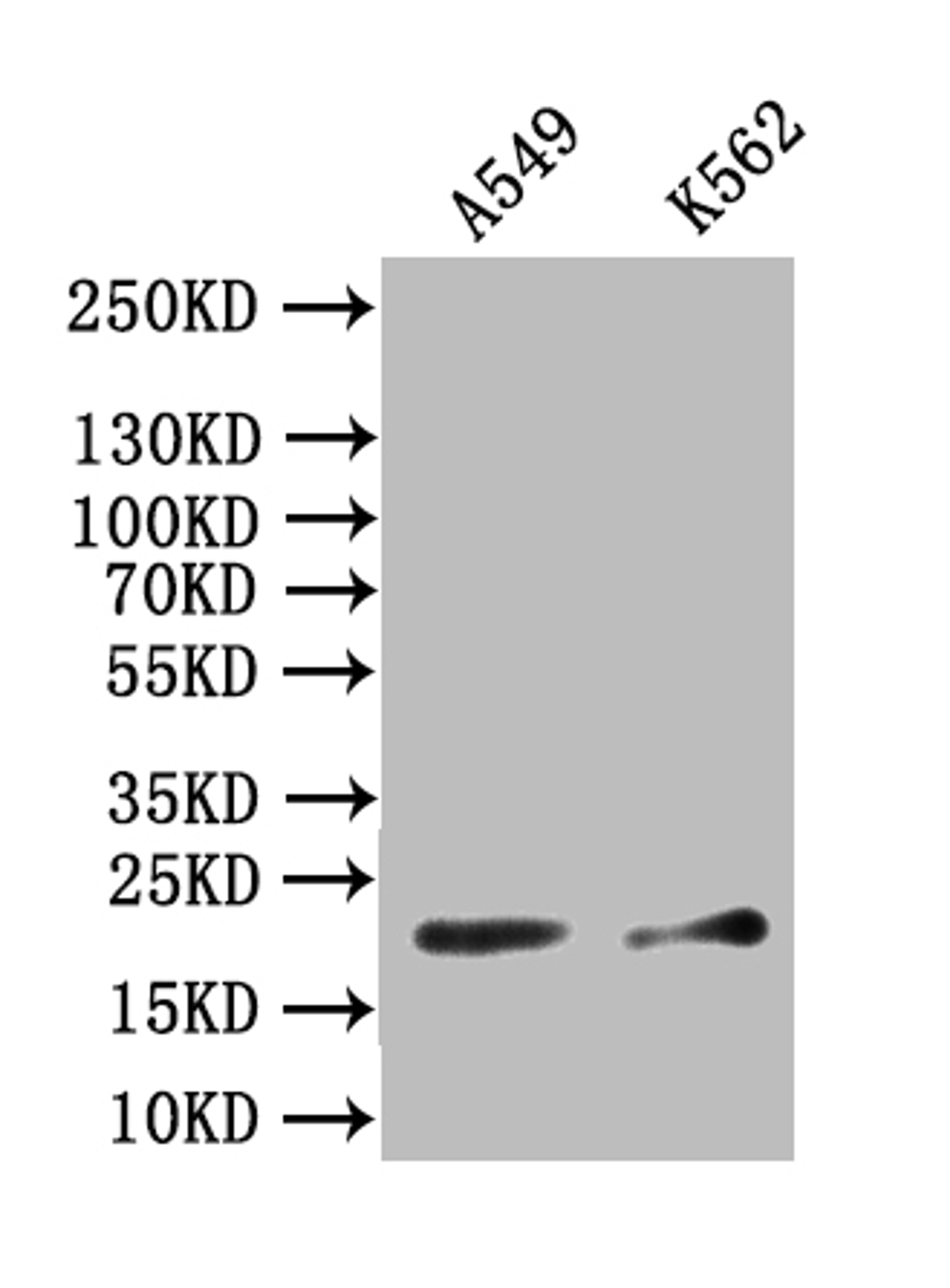 Western Blot. Positive WB detected in: A549 whole cell lysate, K562 whole cell lysate. All lanes: NPPB antibody at 1:1000. Secondary. Goat polyclonal to rabbit IgG at 1/50000 dilution. Predicted band size: 15-25 kDa. Observed band size: 20 kDa.