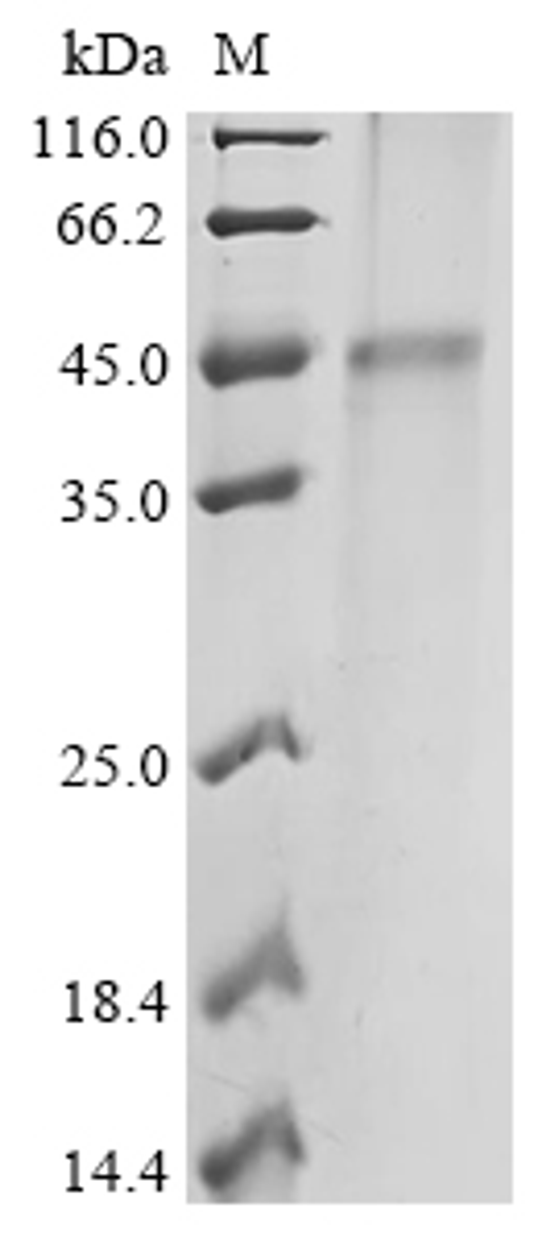(Tris-Glycine gel) Discontinuous SDS-PAGE (reduced) with 5% enrichment gel and 15% separation gel.