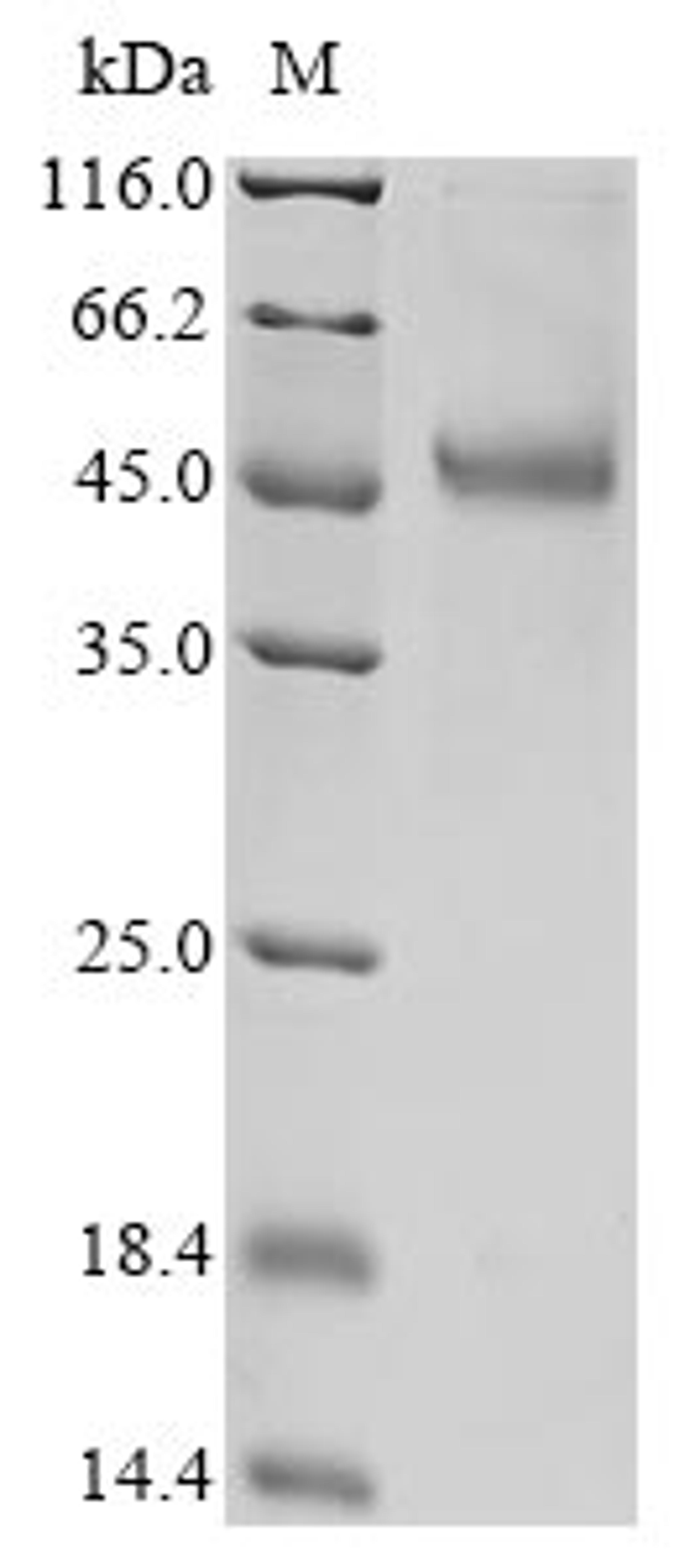 (Tris-Glycine gel) Discontinuous SDS-PAGE (reduced) with 5% enrichment gel and 15% separation gel.