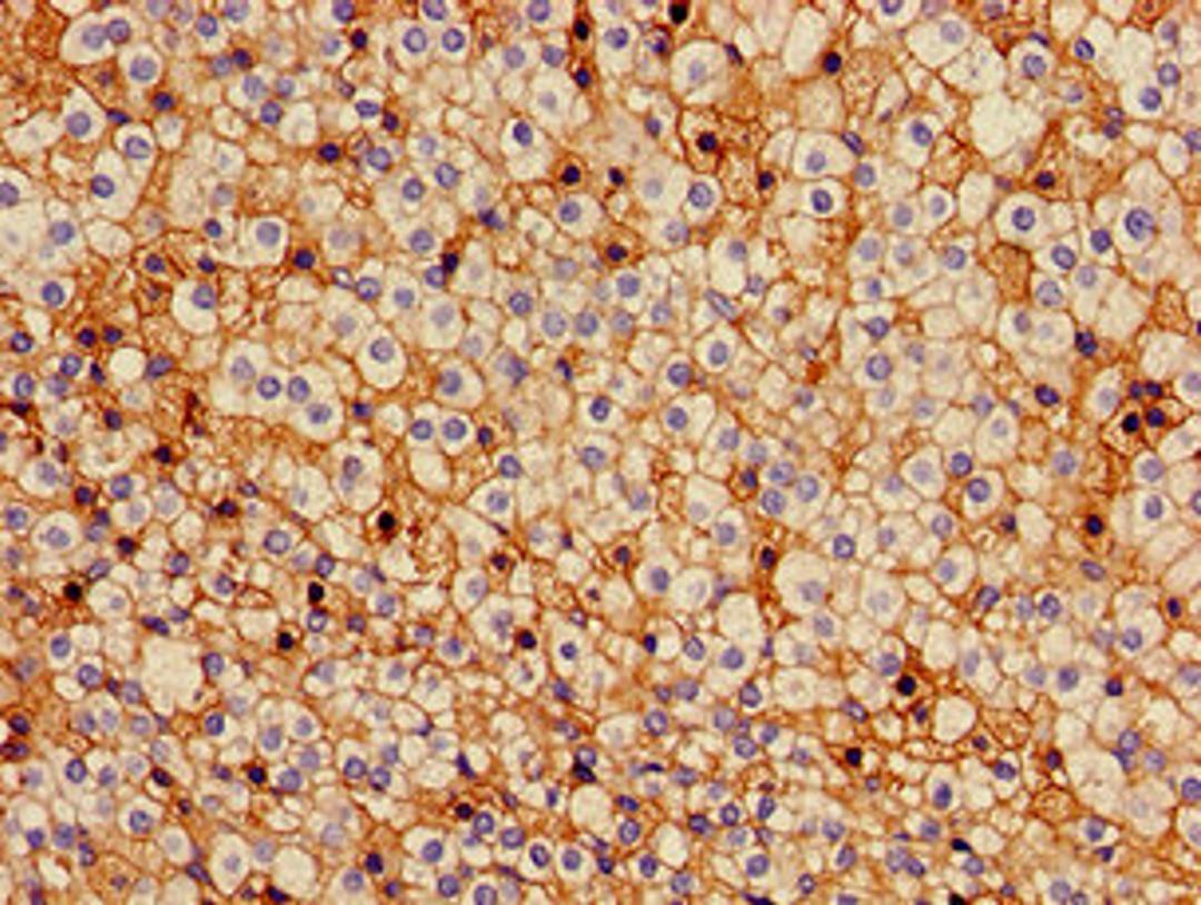 Immunohistochemistry of paraffin-embedded human adrenal gland tissue using CSB-PA009448LA01HU at dilution of 1:100
