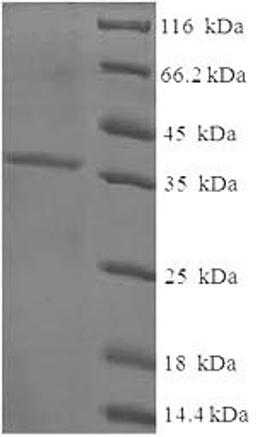 (Tris-Glycine gel) Discontinuous SDS-PAGE (reduced) with 5% enrichment gel and 15% separation gel.