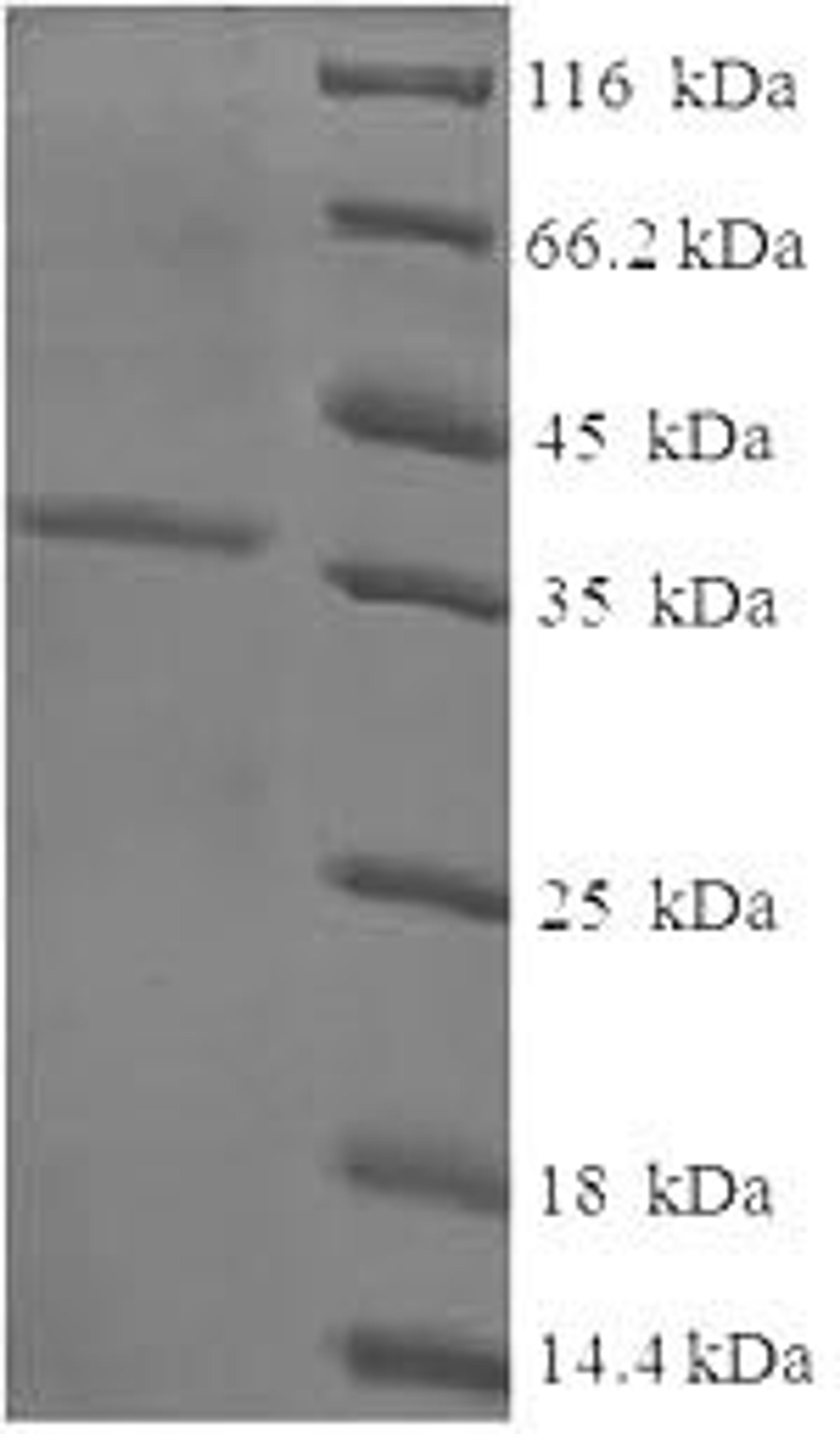 (Tris-Glycine gel) Discontinuous SDS-PAGE (reduced) with 5% enrichment gel and 15% separation gel.