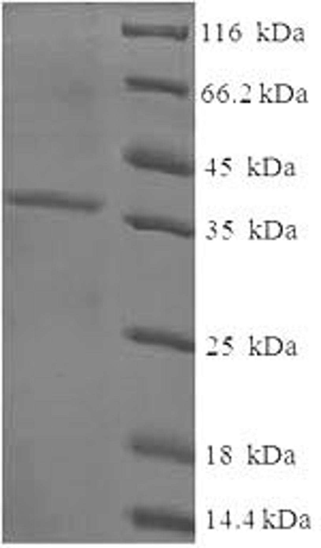 (Tris-Glycine gel) Discontinuous SDS-PAGE (reduced) with 5% enrichment gel and 15% separation gel.