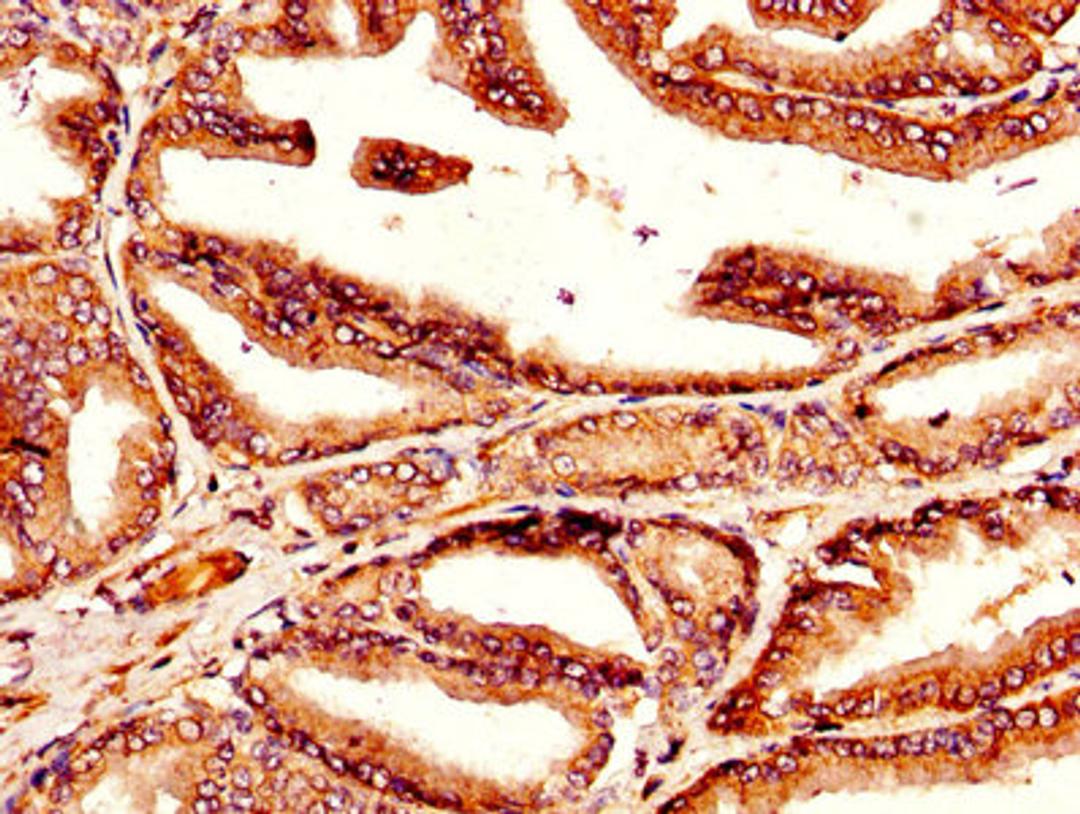 IHC image of CSB-PA023464LA01HU diluted at 1:300 and staining in paraffin-embedded human prostate tissue performed on a Leica BondTM system. After dewaxing and hydration, antigen retrieval was mediated by high pressure in a citrate buffer (pH 6.0). Section was blocked with 10% normal goat serum 30min at RT. Then primary antibody (1% BSA) was incubated at 4&deg;C overnight. The primary is detected by a biotinylated secondary antibody and visualized using an HRP conjugated SP system.