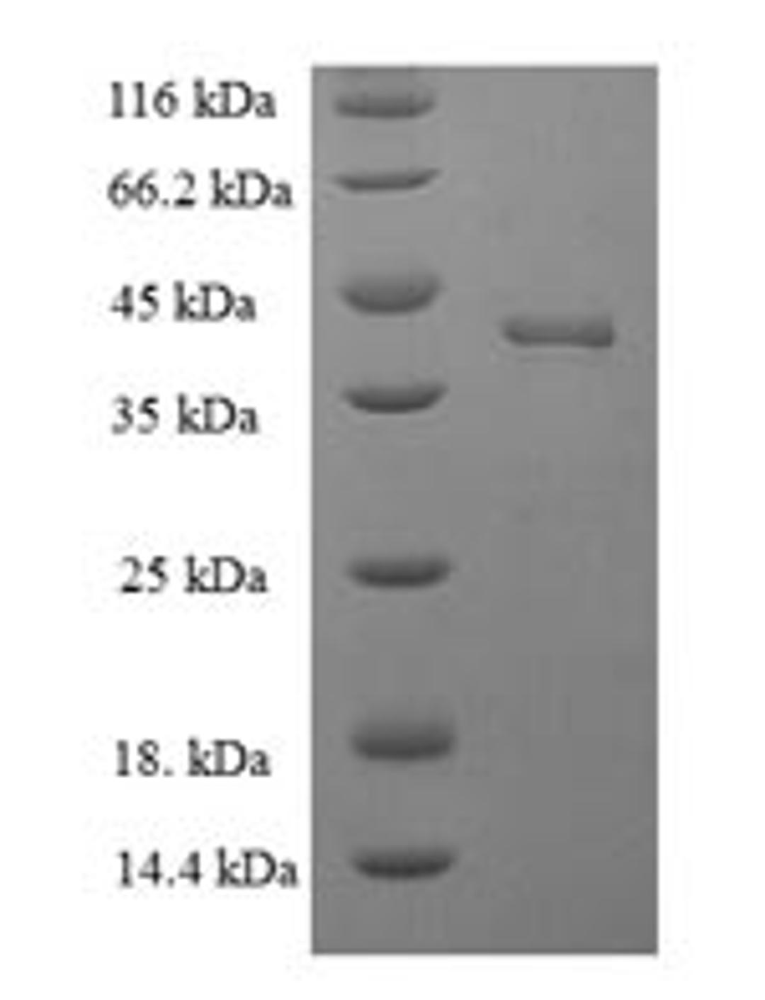 (Tris-Glycine gel) Discontinuous SDS-PAGE (reduced) with 5% enrichment gel and 15% separation gel.
